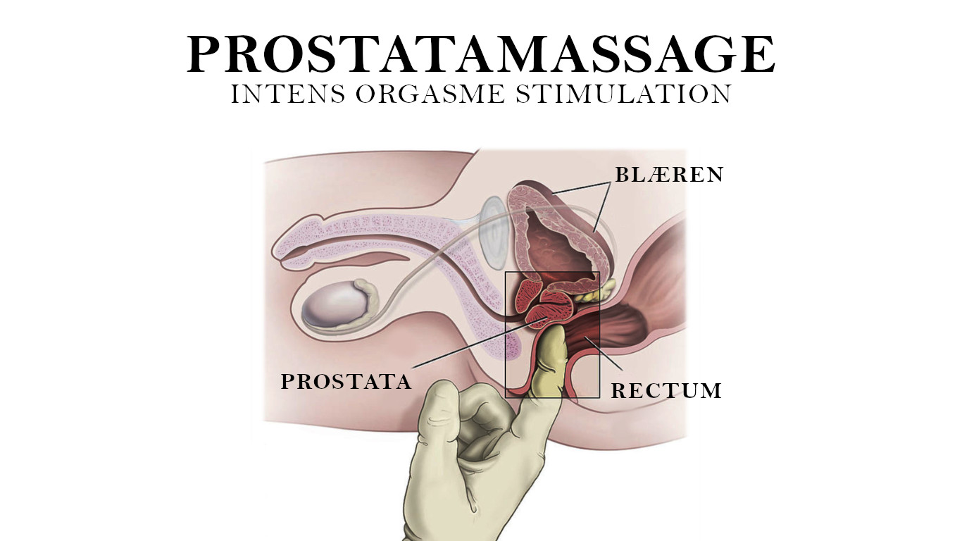 prostatamassage